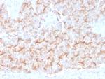 Tubulin-alpha (Microtubule Marker) Antibody in Immunohistochemistry (Paraffin) (IHC (P))