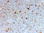 OX40/CD134/TNFRSF4 (Immuno-Oncology Target) Antibody in Immunohistochemistry (Paraffin) (IHC (P))