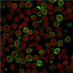 OX40/CD134/ TNFRSF4 (Immuno-Oncology Target) Antibody in Immunocytochemistry (ICC/IF)