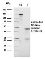 OX40/CD134/ TNFRSF4 (Immuno-Oncology Target) Antibody in SDS-PAGE (SDS-PAGE)