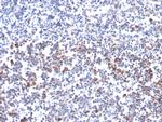 OX40/CD134/TNFRSF4 (Immuno-Oncology Target) Antibody in Immunohistochemistry (Paraffin) (IHC (P))