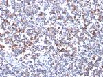 OX40/CD134/TNFRSF4 (Immuno-Oncology Target) Antibody in Immunohistochemistry (Paraffin) (IHC (P))