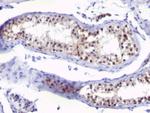 Thymidylate Synthase (5-FU Resistance Marker) Antibody in Immunohistochemistry (Paraffin) (IHC (P))