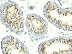 Thymidylate Synthase (5-FU Resistance Marker) Antibody in Immunohistochemistry (Paraffin) (IHC (P))