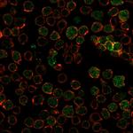 Thymidylate Synthase Antibody in Immunocytochemistry (ICC/IF)