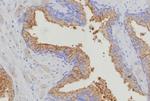 Thymidylate Synthase (5-FU Resistance Marker) Antibody in Immunohistochemistry (Paraffin) (IHC (P))