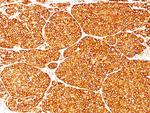 Tyrosinase (Melanoma Marker) Antibody in Immunohistochemistry (Paraffin) (IHC (P))