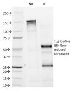 Tyrosinase (Melanoma Marker) Antibody in SDS-PAGE (SDS-PAGE)