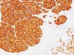 Tyrosinase (Melanoma Marker) Antibody in Immunohistochemistry (Paraffin) (IHC (P))