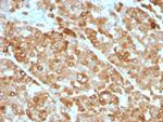 Tyrosinase (Melanoma Marker) Antibody in Immunohistochemistry (Paraffin) (IHC (P))