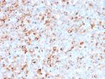 Tyrosinase (Melanoma Marker) Antibody in Immunohistochemistry (Paraffin) (IHC (P))