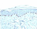 Tyrosinase (Melanoma Marker) Antibody in Immunohistochemistry (Paraffin) (IHC (P))