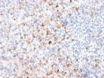 Tyrosinase Antibody in Immunohistochemistry (Paraffin) (IHC (P))