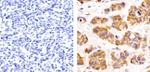 PRMT3 Antibody in Immunohistochemistry (Paraffin) (IHC (P))