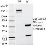 Tyrosinase-Related Protein-1 (TYRP-1) (Melanoma Marker) Antibody in SDS-PAGE (SDS-PAGE)