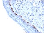 Tyrosinase-Related Protein-1 (TYRP-1) Antibody in Immunohistochemistry (Paraffin) (IHC (P))