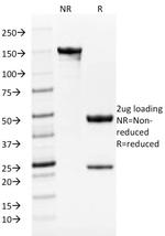 Tyrosinase-Related Protein-1 (TYRP-1) (Melanoma Marker) Antibody in SDS-PAGE (SDS-PAGE)