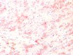 Tyrosinase-Related Protein-1 (TYRP-1) (Melanoma Marker) Antibody in Immunohistochemistry (Paraffin) (IHC (P))