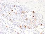 Tyrosinase-Related Protein-1 (TYRP-1) (Melanoma Marker) Antibody in Immunohistochemistry (Paraffin) (IHC (P))