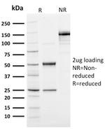 Ubiquitin Antibody in SDS-PAGE (SDS-PAGE)