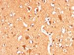 Ubiquitin Antibody in Immunohistochemistry (Paraffin) (IHC (P))