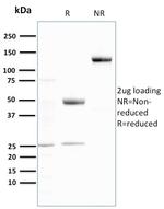 Ubiquitin Antibody in SDS-PAGE (SDS-PAGE)