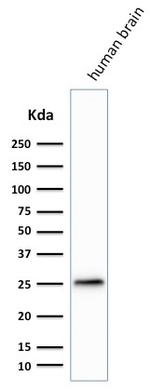 PGP9.5/UchL1 Antibody in Western Blot (WB)