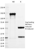 PGP9.5/UchL1 (pan-Neuronal Marker) Antibody in SDS-PAGE (SDS-PAGE)