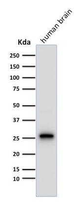 PGP9.5/UchL1 (pan-Neuronal Marker) Antibody in Western Blot (WB)