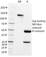 PGP9.5/UchL1 (pan-Neuronal Marker) Antibody in SDS-PAGE (SDS-PAGE)