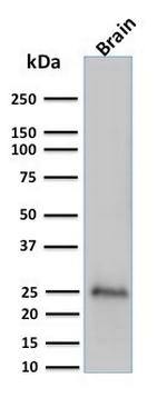 PGP9.5/UchL1 (pan-Neuronal Marker) Antibody in Western Blot (WB)