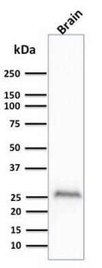 PGP9.5/UchL1 (pan-Neuronal Marker) Antibody in Western Blot (WB)