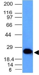 PGP9.5/UchL1 (pan-Neuronal Marker) Antibody in Western Blot (WB)