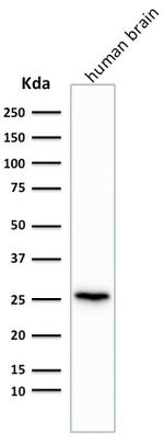 PGP9.5/UchL1 Antibody in Western Blot (WB)