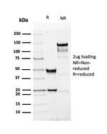 PGP9.5/UchL1 (pan-Neuronal Marker) Antibody in SDS-PAGE (SDS-PAGE)