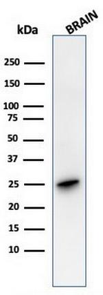 PGP9.5/UchL1 (pan-Neuronal Marker) Antibody in Western Blot (WB)