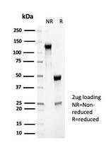 PGP9.5/UchL1 (pan-Neuronal Marker) Antibody in SDS-PAGE (SDS-PAGE)