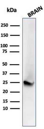 PGP9.5/UchL1 Antibody in Western Blot (WB)