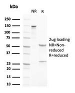 Liver X Receptor beta (LXRB) (Orphan Receptor) Antibody in SDS-PAGE (SDS-PAGE)