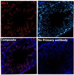 ZO-1 Antibody in Immunohistochemistry (Paraffin) (IHC (P))