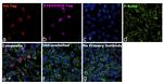 HA Tag Antibody in Immunocytochemistry (ICC/IF)