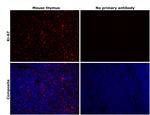 Ki-67 Antibody in Immunohistochemistry (Paraffin) (IHC (P))