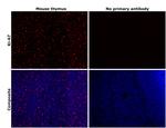 Ki-67 Antibody in Immunohistochemistry (Paraffin) (IHC (P))