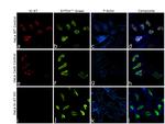 Ki-67 Antibody in Immunocytochemistry (ICC/IF)