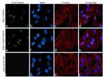 Ki-67 Antibody in Immunocytochemistry (ICC/IF)