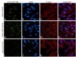 Ki-67 Antibody