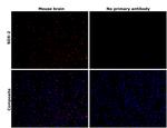 SOX2 Antibody in Immunohistochemistry (Paraffin) (IHC (P))