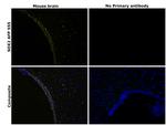 SOX2 Antibody in Immunohistochemistry (Paraffin) (IHC (P))