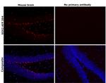 SOX2 Antibody in Immunohistochemistry (Paraffin) (IHC (P))