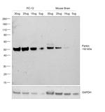 Parkin Antibody in Western Blot (WB)